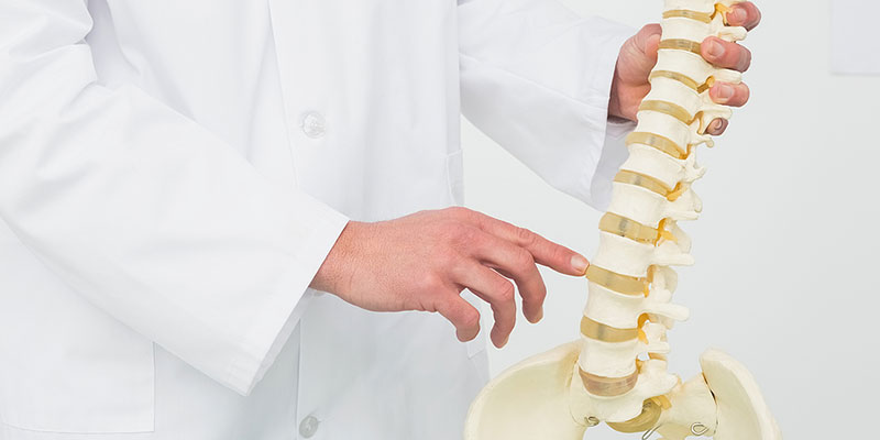 Doctor holding a model of a spine indicating a herniated disk in Gresham OR